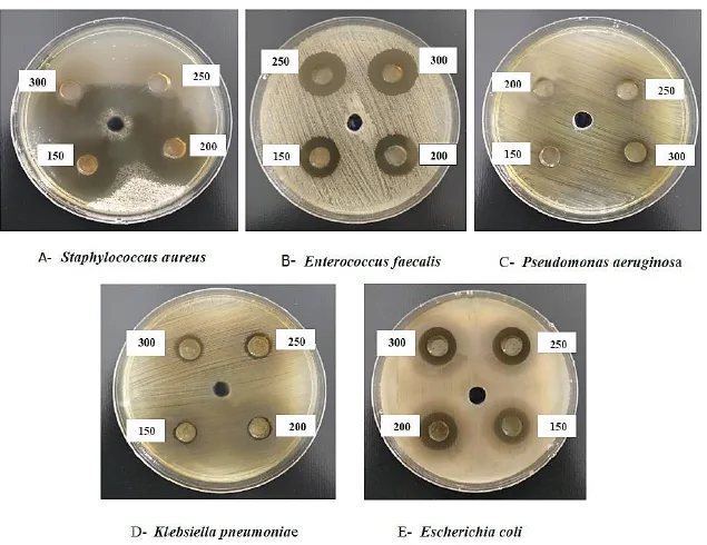 Study The Effect of The Alcoholic and Hot Aqueous Extract of Costus specious on Some Bacterial Species 1 2b593d5b fi png
