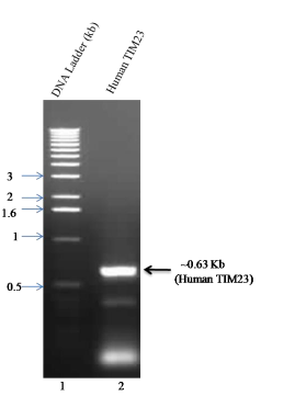 Application of pET28a Vector for the Over Expression of Recombinant Human Tim23 Protein in E. coli and its Validation by Immunoblotting 1 324c088e fe