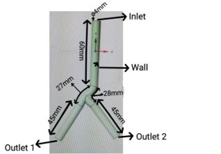 Computational Analysis of Non-Newtonian Blood Flow through Bifurcated Coronary Artery: Insights into Hemodynamics and Wall Shear Stress 1 e54ea866 feature image