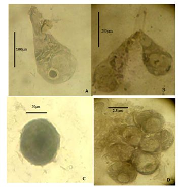Didymophyes bayaramae sp.nov., a new septate gregarine (Protozoa: Apicomplexa) from Aphis fabae of Manipur 1 fec3ef70 screenshot 2024 07 03 155448