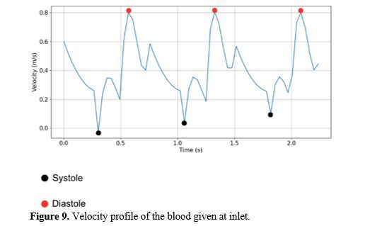 Revealing the Hemodynamic Orchestra: Contrasting Analysis of Blood Flow Patterns in a Bifurcated Carotid Artery 10 figures