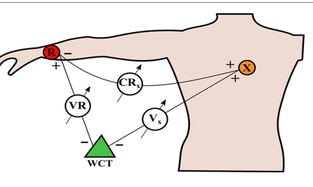 A Review on Electro Cardio Graph a New Approach 2 figures