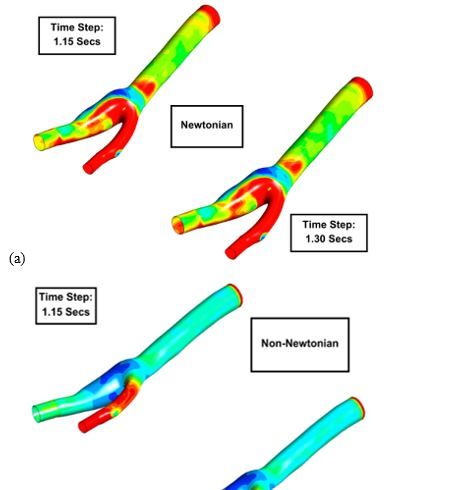 Revealing the Hemodynamic Orchestra: Contrasting Analysis of Blood Flow Patterns in a Bifurcated Carotid Artery 20 figures