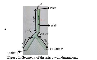 Computational Analysis of Non-Newtonian Blood Flow through Bifurcated Coronary Artery: Insights into Hemodynamics and Wall Shear Stress 2 figures