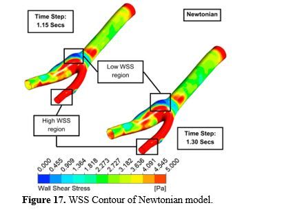 Revealing the Hemodynamic Orchestra: Contrasting Analysis of Blood Flow Patterns in a Bifurcated Carotid Artery 18 figures