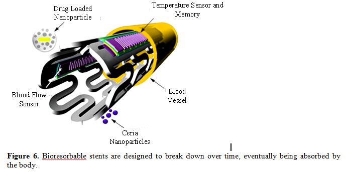 Overview of Recent Advancement of Nano Stent in Pharmaceutical Application 7 figures