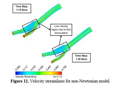 Revealing the Hemodynamic Orchestra: Contrasting Analysis of Blood Flow Patterns in a Bifurcated Carotid Artery 13 figures