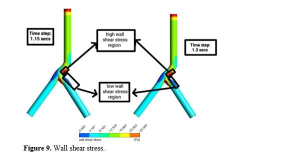 Computational Analysis of Non-Newtonian Blood Flow through Bifurcated Coronary Artery: Insights into Hemodynamics and Wall Shear Stress 10 figures