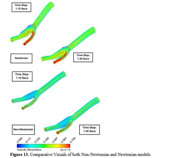 Revealing the Hemodynamic Orchestra: Contrasting Analysis of Blood Flow Patterns in a Bifurcated Carotid Artery 14 figures