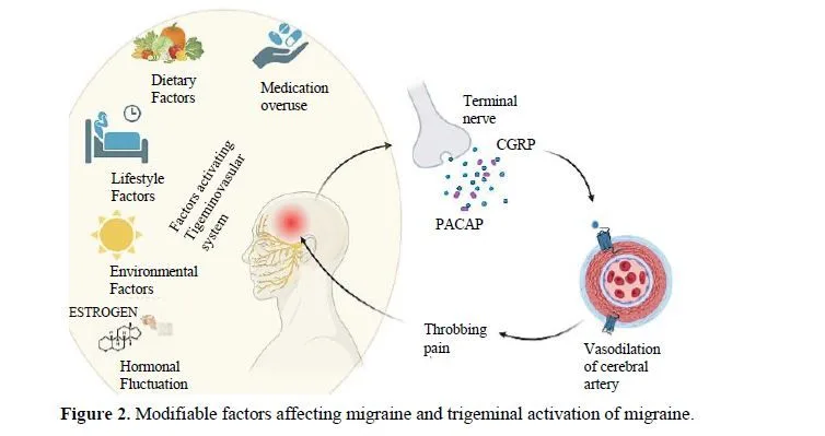 Deciphering the Pathophysiology of Migraine: Understanding Trigeminovascular System Activity and the Importance of the Gut-Brain Axis 3 figures