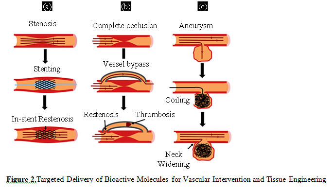 Overview of Recent Advancement of Nano Stent in Pharmaceutical Application 3 figures