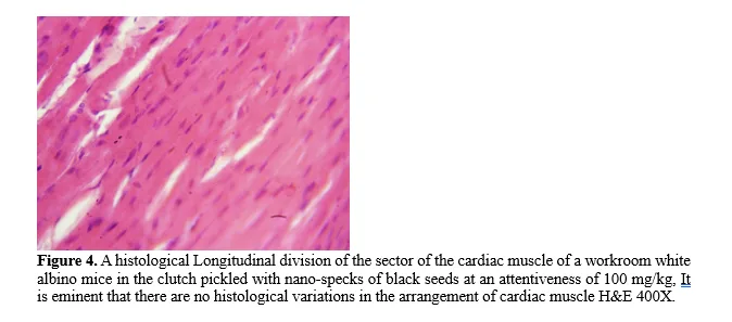 Effect of Nano-Prepared N. sativa Seed Extract on Cardiac Tissue Structure in Tartrazine-Treated Male Albino Mice 5 figures