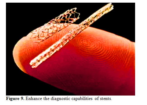 Overview of Recent Advancement of Nano Stent in Pharmaceutical Application 10 figures