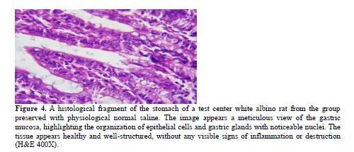 Histological Effects of Nano-Synthesized Particles of Nagilla Sativa Seeds Extract on Digestive System of Male Albino Mice 5 figures