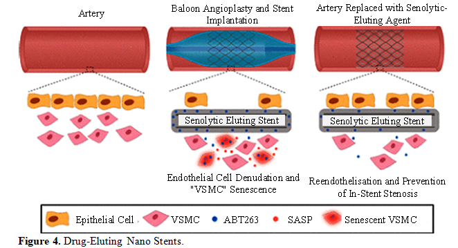 Overview of Recent Advancement of Nano Stent in Pharmaceutical Application 5 figures
