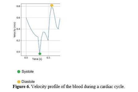 Computational Analysis of Non-Newtonian Blood Flow through Bifurcated Coronary Artery: Insights into Hemodynamics and Wall Shear Stress 7 figures