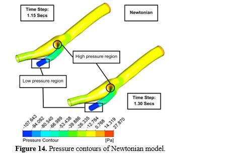 Revealing the Hemodynamic Orchestra: Contrasting Analysis of Blood Flow Patterns in a Bifurcated Carotid Artery 15 figures