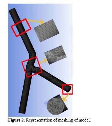 Computational Analysis of Non-Newtonian Blood Flow through Bifurcated Coronary Artery: Insights into Hemodynamics and Wall Shear Stress 3 figures