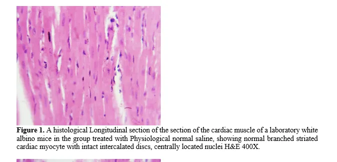 Effect of Nano-Prepared N. sativa Seed Extract on Cardiac Tissue Structure in Tartrazine-Treated Male Albino Mice 2 figures