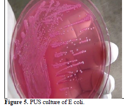 Patient Profile and Antimicrobial Susceptibility Testing of Clinically Isolates In E. coli 6 figures