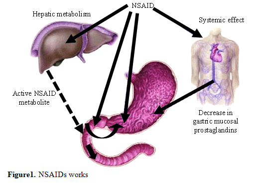 Strategies in the Delivery of Nonsteroidal Antiinflammatory Drugs 2 figures