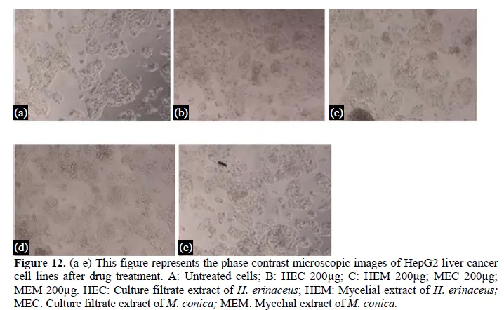 Evaluation of Antioxidant and Cytotoxic activities of Mycelia Biomass and Culture broth of three Edible Mushrooms, Morchella conica, Hericium erinaceus and Pleurotus florida Grown in Submerged Culture 13 figures
