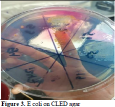 Patient Profile and Antimicrobial Susceptibility Testing of Clinically Isolates In E. coli 4 figures