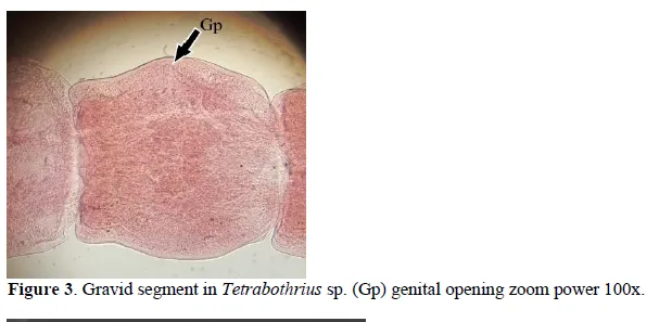Description of the Tapeworm Tetrabothrius rudolphi, 1819 (Fam: Tetrabothriidae) in Domestic Chickens Gallus gallus domsticus 4 figures