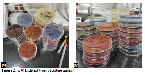 Patient Profile and Antimicrobial Susceptibility Testing of Clinically Isolates In E. coli 3 figures
