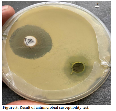Exploring the properties and extraction of neem leaves 6 figures