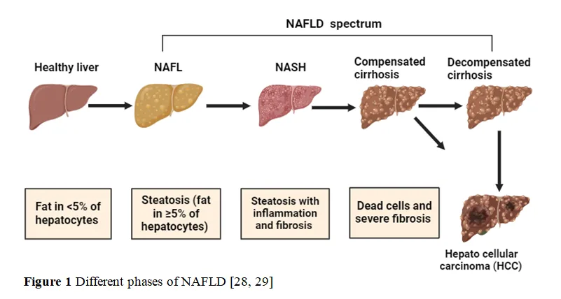 The Role of Pyruvate Dehydrogenase in Non-Alcoholic Fatty Liver Disease: Therapeutic Insights and Future Directions 2 figures