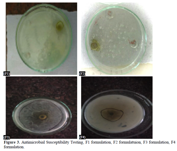 Formulation and Analyzation of Murraya Koenigii Herbal Antimicrobial Cream 4 figures