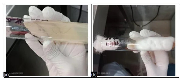 Epidemiology and Mycological Analysis of Superficial Mycosis in a Northern Indian Tertiary Care Hospital 12 figures