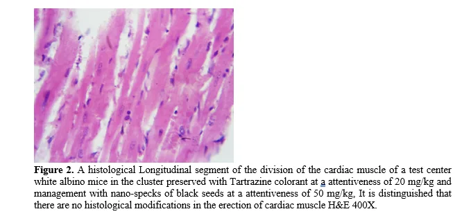 Effect of Nano-Prepared N. sativa Seed Extract on Cardiac Tissue Structure in Tartrazine-Treated Male Albino Mice 3 figures