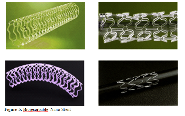 Overview of Recent Advancement of Nano Stent in Pharmaceutical Application 6 figures
