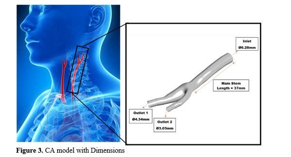 Revealing the Hemodynamic Orchestra: Contrasting Analysis of Blood Flow Patterns in a Bifurcated Carotid Artery 4 figures