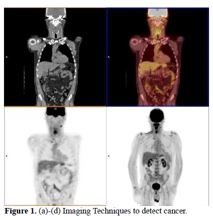 Non -Invasive Ways to Detect Cancer 2 figures