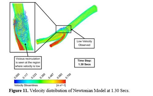 Revealing the Hemodynamic Orchestra: Contrasting Analysis of Blood Flow Patterns in a Bifurcated Carotid Artery 12 figures