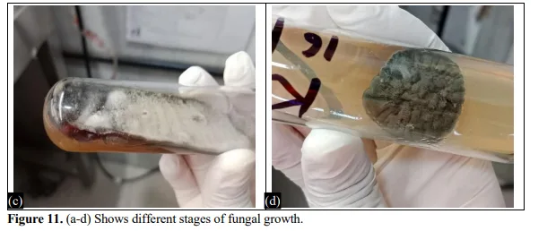Epidemiology and Mycological Analysis of Superficial Mycosis in a Northern Indian Tertiary Care Hospital 13 figures