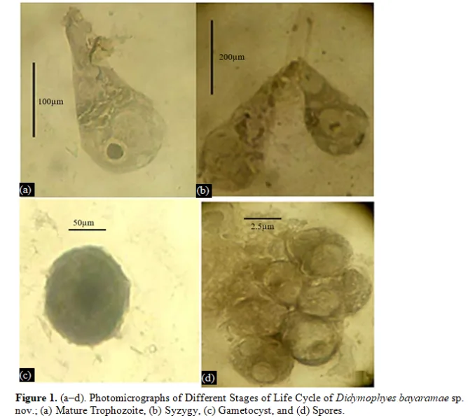 Didymophyes bayaramae sp.nov., a new septate gregarine (Protozoa: Apicomplexa) from Aphis fabae of Manipur 2 figures