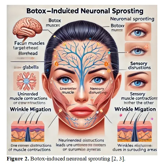 A Short Review on Long-Term Effects of Botox on Neuronal Sprouting: Mechanisms and Its Clinical Implications 3 figures
