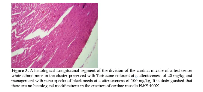 Effect of Nano-Prepared N. sativa Seed Extract on Cardiac Tissue Structure in Tartrazine-Treated Male Albino Mice 4 figures