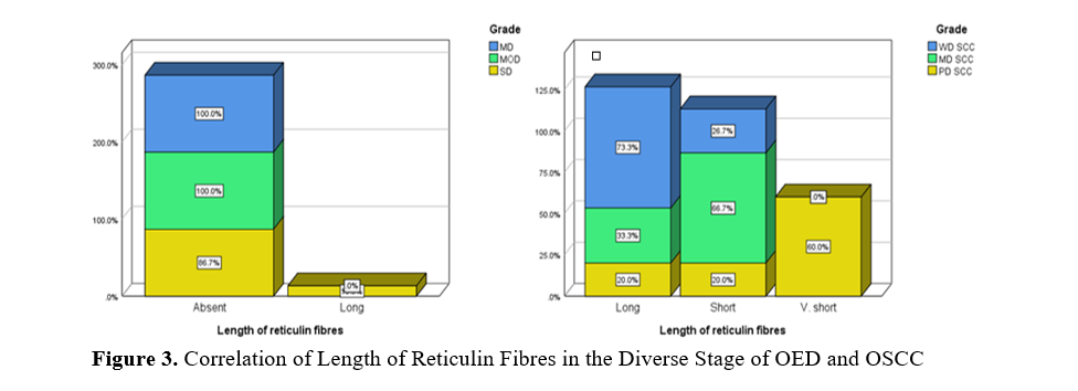 Examining Connective Tissue Changes Across Various Grades of Oral Epithelial Dysplasia and Oral Squamous Cell Carcinoma: A Histochemical Polymeric Investigation 4 figures