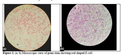 Patient Profile and Antimicrobial Susceptibility Testing of Clinically Isolates In E. coli 2 figures