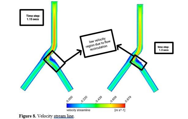Computational Analysis of Non-Newtonian Blood Flow through Bifurcated Coronary Artery: Insights into Hemodynamics and Wall Shear Stress 9 figures