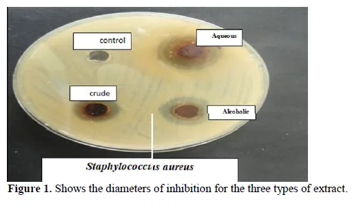 The Effect of Alcoholic, Aqueous and Crude Extracts of Lemon citrus Seeds on Staphylococcus and Klebsiella Bacteria 2 figures