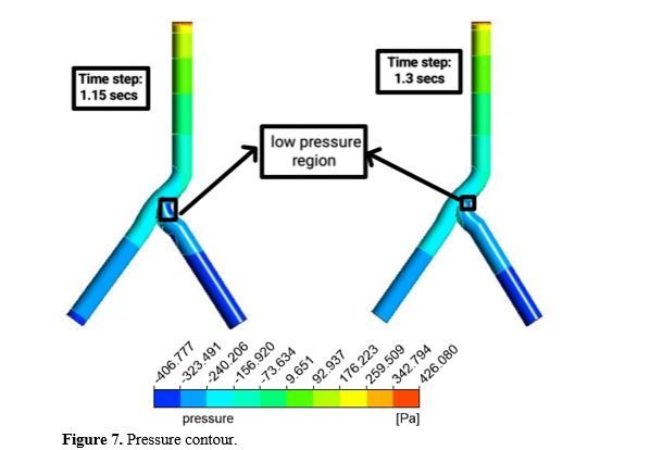 Computational Analysis of Non-Newtonian Blood Flow through Bifurcated Coronary Artery: Insights into Hemodynamics and Wall Shear Stress 8 figures