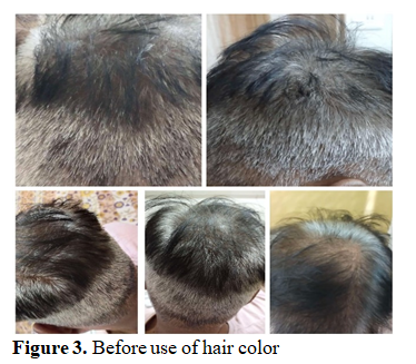 Method of Making Organic Insecticides, Hair Color and Lip Lotion by Utilizing Natural Constituents 4 figures