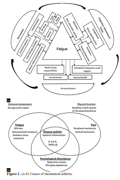DMARDs, Biologic Agents and Novel Experimental Strategies in The Treatment of Rheumatoid Arthritis 3 figures