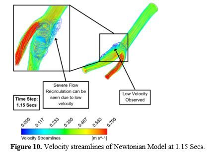Revealing the Hemodynamic Orchestra: Contrasting Analysis of Blood Flow Patterns in a Bifurcated Carotid Artery 11 figures